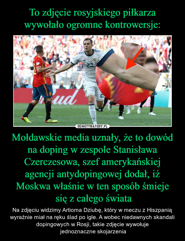 Mołdawskie media uznały, że to dowód na doping w zespole Stanisława Czerczesowa, szef amerykańskiej agencji antydopingowej dodał, iż Moskwa właśnie w ten sposób śmieje się z całego świata – Na zdjęciu widzimy Artioma Dziubę, który w meczu z Hiszpanią wyraźnie miał na ręku ślad po igle. A wobec niedawnych skandali dopingowych w Rosji, takie zdjęcie wywołuje jednoznaczne skojarzenia 