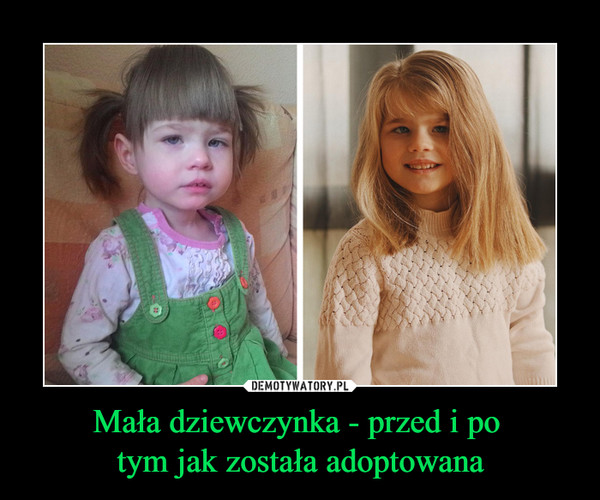 Mała dziewczynka - przed i po tym jak została adoptowana –  