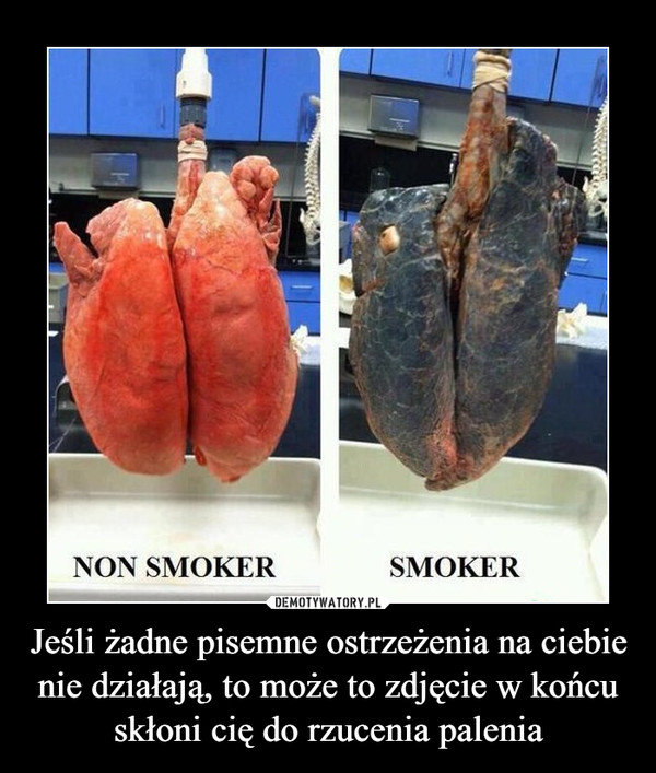 Jeśli żadne pisemne ostrzeżenia na ciebie nie działają, to może to zdjęcie w końcu skłoni cię do rzucenia palenia –  