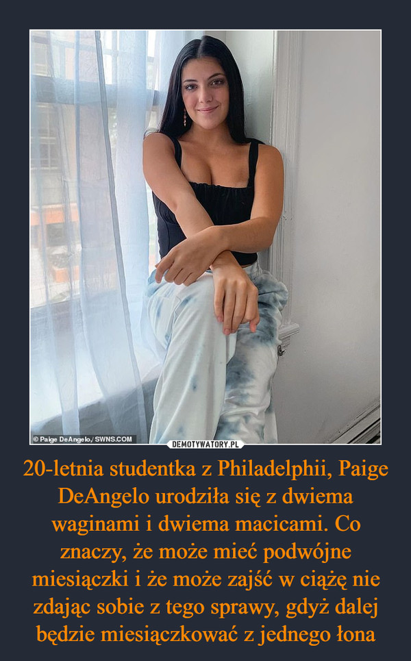 20-letnia studentka z Philadelphii, Paige DeAngelo urodziła się z dwiema waginami i dwiema macicami. Co znaczy, że może mieć podwójne miesiączki i że może zajść w ciążę nie zdając sobie z tego sprawy, gdyż dalej będzie miesiączkować z jednego łona –  