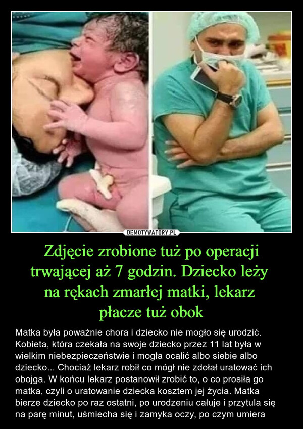 Zdjęcie zrobione tuż po operacji trwającej aż 7 godzin. Dziecko leży 
na rękach zmarłej matki, lekarz 
płacze tuż obok